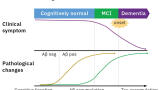 MS detection of Alzheimer’s blood-based biomarkers - From a few drops of blood - the first successful detection of plasma Aβ by MS