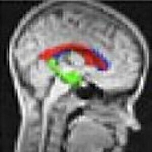 Lab product news from York 'could revolutionise MRI'