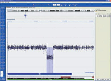 Array Ensures Increased Confidence in Detecting DMD Gene Gains and Losses