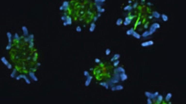 Scientists tackle how Cell Division Mistakes Lead To Human Disorders