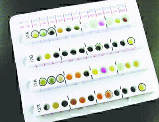 Biochemical Identification Systems Allow Rapid Identification of Clinically Significant Micro-organisms