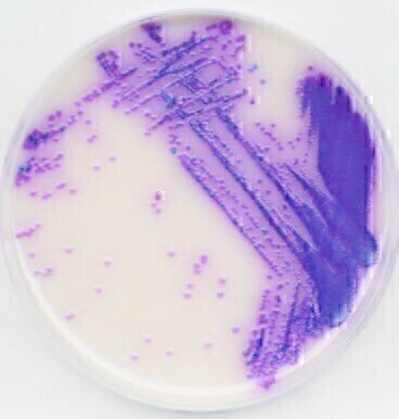 Identifying Salmonella Species in Duck Eggs in Two Days