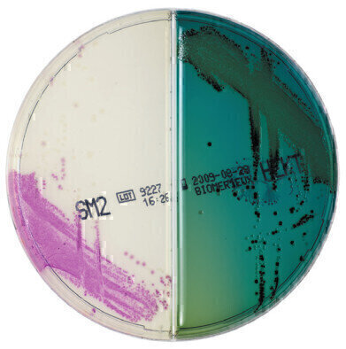 Extra Colour with ChromID Bi-Plates