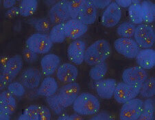 Fully Automated HER2 FISH Test