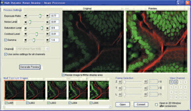 Advancing FluoView Functionality