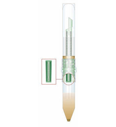 New Solvent Free Parasite Faecal Concentration System