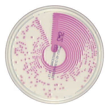 Chromogenic Media Detects S. typhi and S. paratyphi