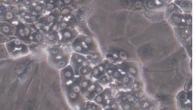 New Distributor of Cryopreserved Terminally Differentiated Human Hepatic Cells