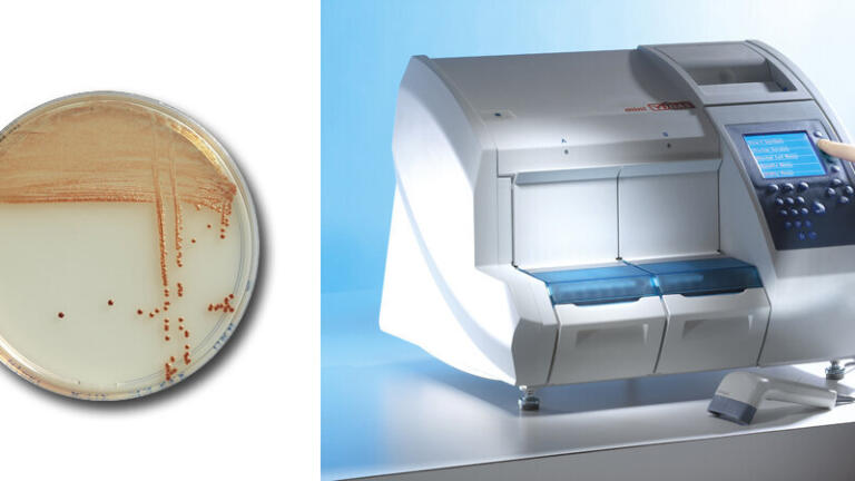 Comprehensive Solution Rapidly Detects and Enumerates Campylobacter in Foods