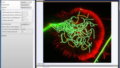 Software with Comprehensive Neuronal Morphology Module Introduced