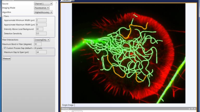 Software with Comprehensive Neuronal Morphology Module Introduced