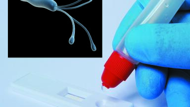 New Easy-Card H.pylori Antigen Test 