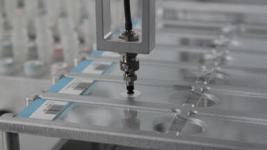 Automated Fluorescence In Situ Hybridisation