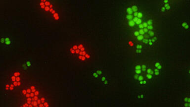 Identification of S. aureus from Positive Blood Culture in just 20 Minutes