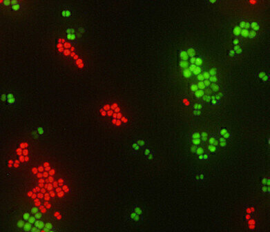 Identification of S. aureus from Positive Blood Culture in just 20 Minutes