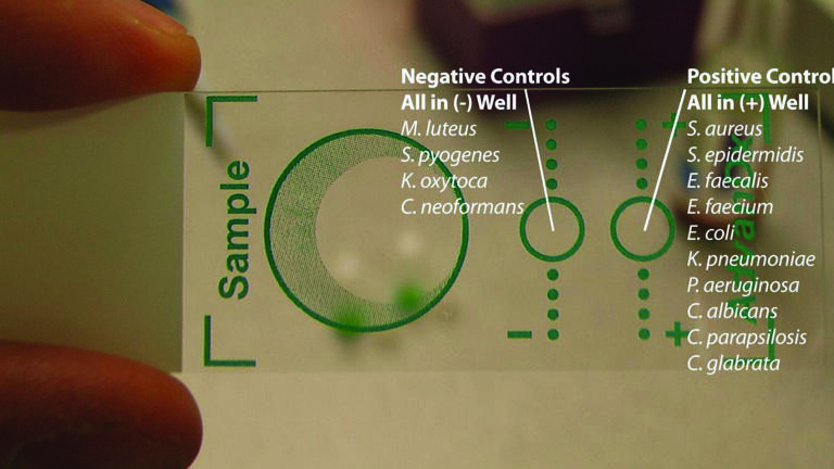 Enterococcus BC Rapid Molecular Diagnostic Test Now Available