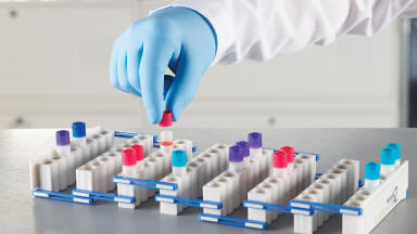 New Expanding Storage Box Provides Innovative Solution for Cryogenic Samples