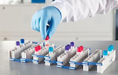 New Expanding Storage Box Provides Innovative Solution for Cryogenic Samples