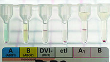 Convenient and Accurate Ready-to-Use Cell Suspensions for Column Agglutination 