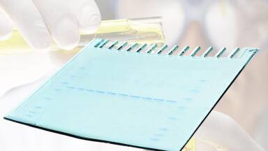 Precast Gels provide Speed and Flexibility  