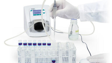 Smart and Compact Programmable Peristaltic Pump