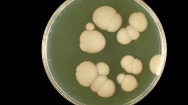 New Formulation Fungal Susceptibility Card to include Micafungin