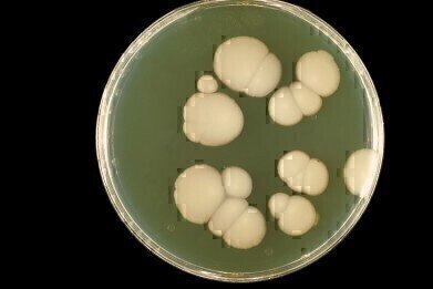 New Formulation Fungal Susceptibility Card to include Micafungin
