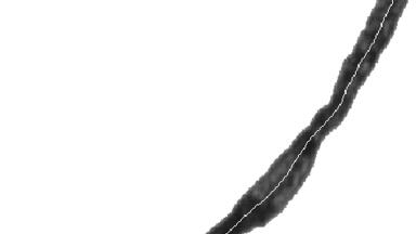 Fibre Analysis Capabilities added in new software for Particle Characterisation System