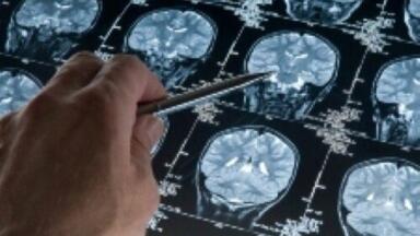 Brain scans suggest biological reason for dyslexia