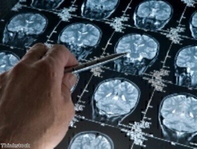 Brain scans suggest biological reason for dyslexia