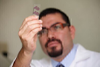 NICE recommends Test for patients with Lung Cancer
