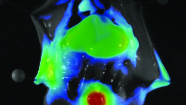 Near Infrared Dye Distribution in a Nude Mouse