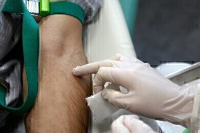 Small Gauge Needle reduces discomfort for patients and protects staff from Needle Stick Injury during Arterial Blood Collection
