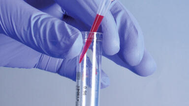 Advancing the Science of Flow Cytometry with Beckman Coulter