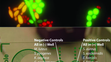 Yeast Species Identification from Positive Blood Culture in just 20 Minutes