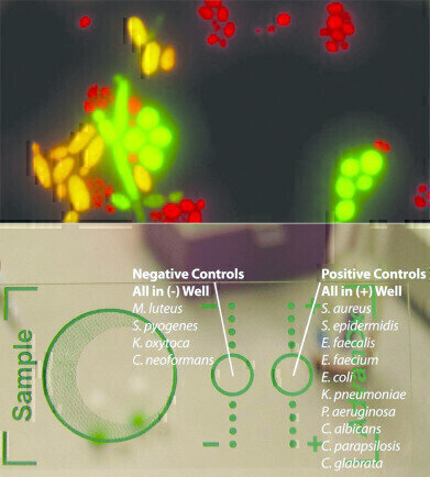 Yeast Species Identification from Positive Blood Culture in just 20 Minutes
