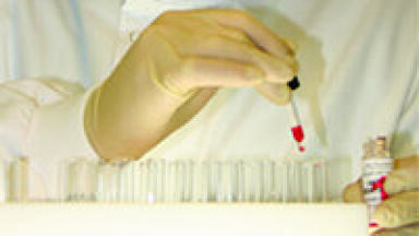 Albasure Sensitivity Controls for Routine Compatibility and Antibody Screening Testing