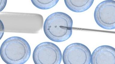 Gene variant links MCI to brain atrophy