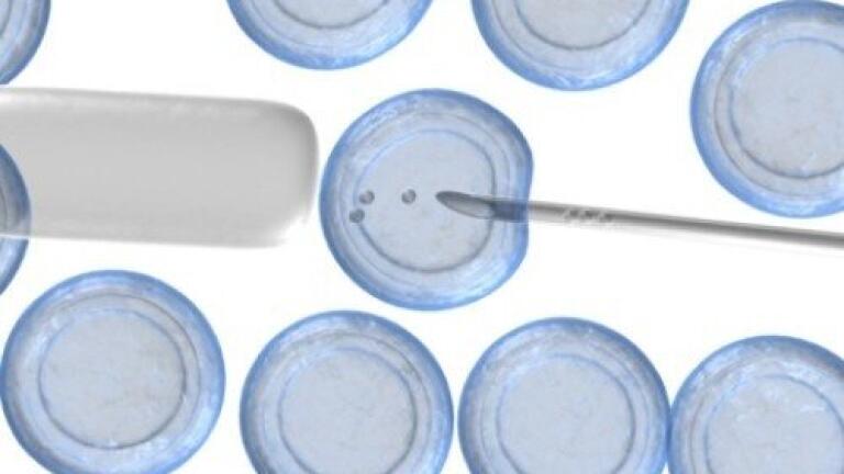 Gene variant links MCI to brain atrophy