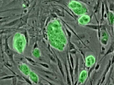 Lab-grown vaginas prove long-term success