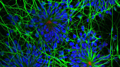 High Quality in vitro Cell Models for Cortical Neurophysiology