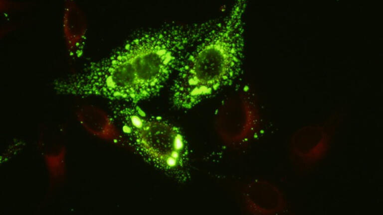New Monoclonal Antibodies to Mumps Virus