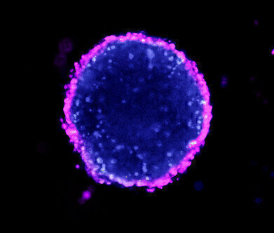Ultra Low Adhesion Plates for Superior 3D Spheroid Cell Culture 
