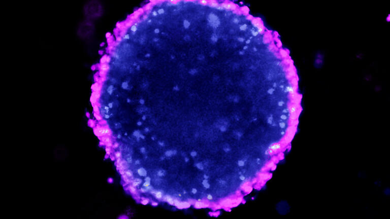 Ultra Low Adhesion Plates for Superior 3D Spheroid Cell Culture 