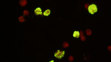 New Parvovirus B19 Monoclonal Antibody