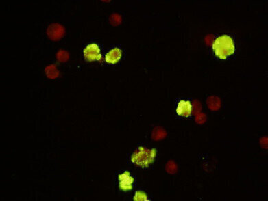 New Parvovirus B19 Monoclonal Antibody
