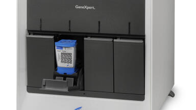 Molecular Test for Rapid and Accurate Detection of Carbapenemase-producing Gram-negative Bacteria released in Europe