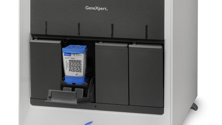 Molecular Test for Rapid and Accurate Detection of Carbapenemase-producing Gram-negative Bacteria released in Europe