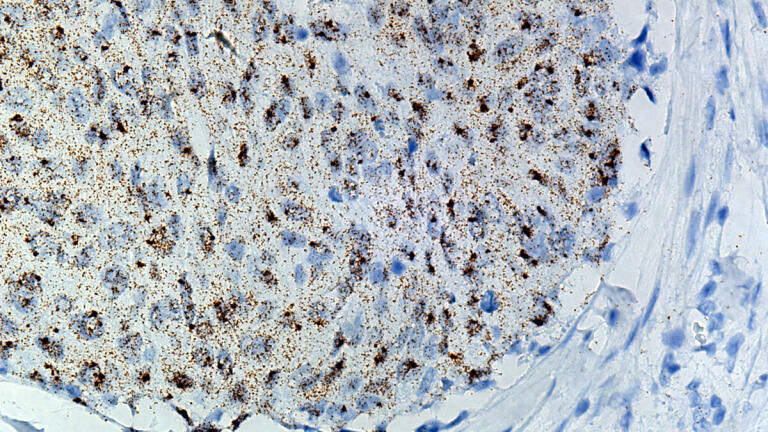 Advanced Cell Diagnostics Receives ISO Certification