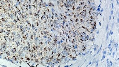 RNAscope® Technology Poised for Development as a Diagnostic Platform